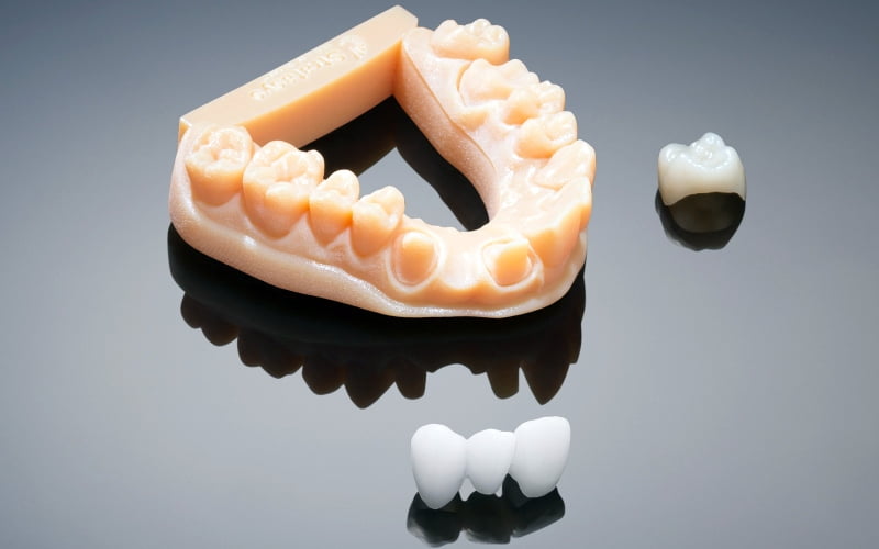 How 3D Printers Are Revolutionising Dentistry in India